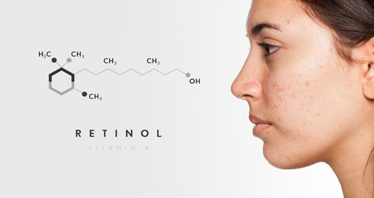 retinol – tác dụng với các tùy chọn điều trị như thế nào