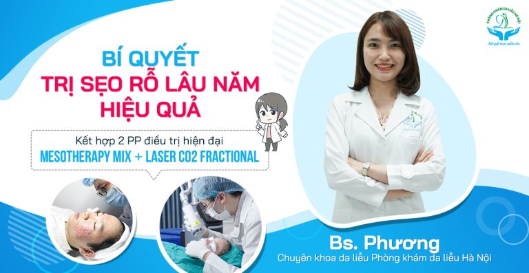 Trị Sẹo Rỗ Hiệu Quả #1 – Phác Đồ Chuẩn Da Liễu Từ A–Z