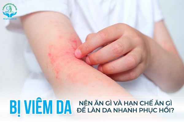 Thực đơn cho bệnh nhân viêm da