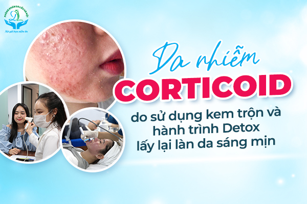 Ca nhiễm nặng Corticoid do sử dụng kem trộn và hành trình Detox lấy lại làn da sáng mịn