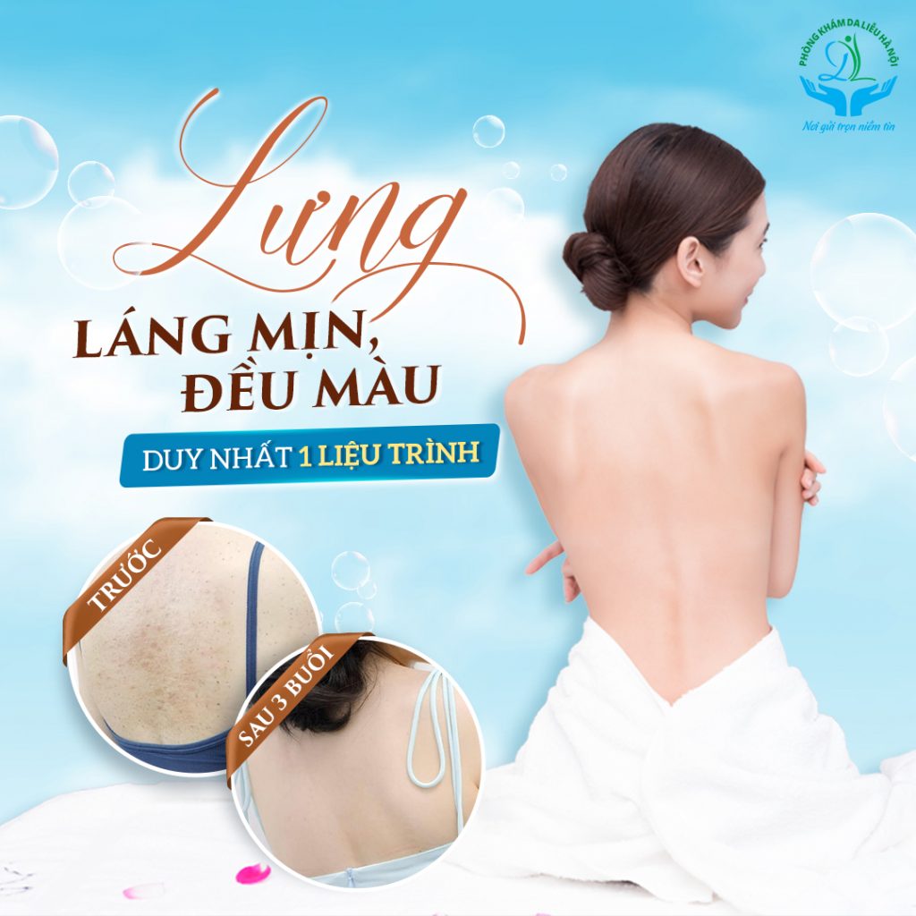 Điều trị mụn lưng lâu năm hiệu quả nhanh nhất