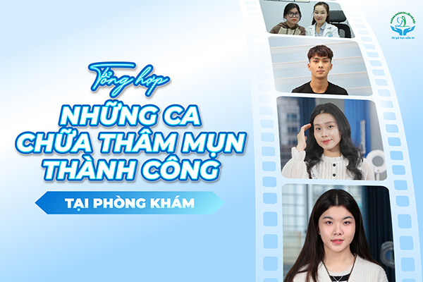 Tổng hợp những ca chữa thâm mụn hiệu quả tại Phòng khám