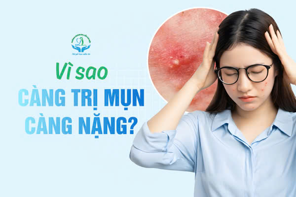 Vì sao trị mụn nhưng da nặng hơn? Phân biệt chưa đáp ứng và kích ứng