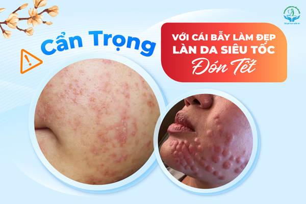 Cẩn trọng với “bẫy” làm đẹp da siêu tốc đón Tết