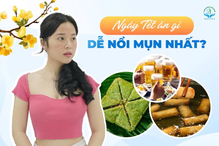 Ngày Tết ăn gì dễ nổi mụn nhất?