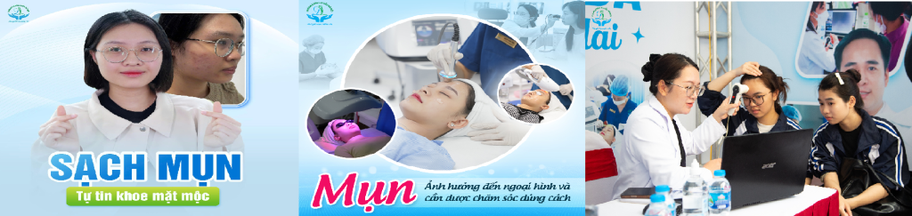 Da sạch láng mịn