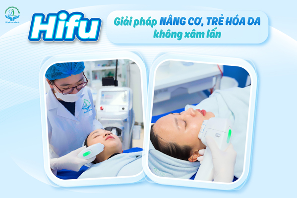 Hifu – Giải pháp nâng cơ, trẻ hóa da không xâm lấn