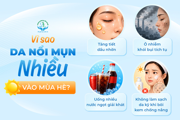 Vì sao da nổi mụn nhiều vào mùa hè?